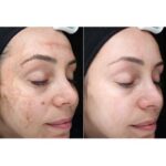 کوکتل ضدلک SWS ژنوسیس 2میل