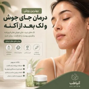 بهترین روش درمان جای جوش و لک بعد از آکنه چیست؟